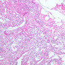 A35, Lymph Node, 10x (H&E)