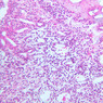 A35, Lymph Node, 20x (H&E)