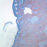 A36, Spleen, 2.5x (Aniline Blue)