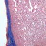 A36, Spleen (Sinus), 10x (Aniline Blue)