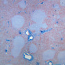 A36, Spleen, 2.5x (Aniline Blue)