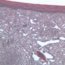 A37, Spleen, 10x (Reticulin)