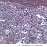 A37, Spleen, 40x Labeled (Reticulin)