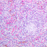 A39, Spleen, 20x (H&E)