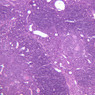 A44, Thymus (Infant), 10x (H&E)