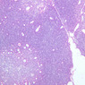 A44, Thymus (Infant), 10x (H&E)