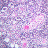 A45, Thymus (Infant), 20x (H&E)