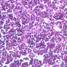 A45, Thymus (Infant), 40x (H&E)