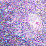 A45, Thymus (Infant), 20x (H&E)