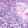 A45, Thymus (Infant), 40x (H&E)