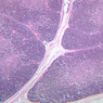 A45, Thymus (Infant), 2.5x (H&E)