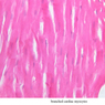 A20, Cardiac Muscle, 40x Labeled (H&E)