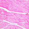 A25, Left Ventricle (Cardiac Muscle), 20x (H&E)