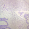 Neural Tissue