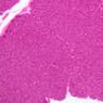 B36, Pancreas, 10x (H&E)