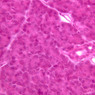 B36, Pancreas, 40x (H&E)