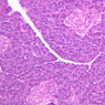 B36, Pancreas, 20x (H&E)