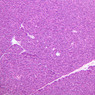 B36, Pancreas, 10x (H&E)
