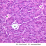 B36, Pancreas, 40x Labeled (H&E)