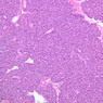 B36, Pancreas, 10x (H&E)