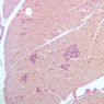B37, Pancreas, 10x (AF)