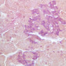 B37, Pancreas, 40x (AF)