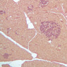 B37, Pancreas, 10x (AF)