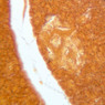 B40, Pancreas, 20x (Ag)