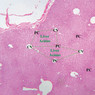 B29, Liver, 2.5x Labeled (H&E)