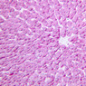 B31, Liver, 20x (PAS)