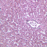 B32, Liver, 20x (Reticulin)