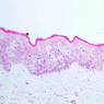 A48, Abdominal Skin (Dark), 20x (H&E)