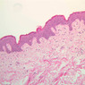 A48, Abdominal Skin, 10x (H&E)