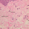 A48, Abdominal Skin, 40x Labeled (H&E)