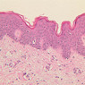 A48, Abdominal Skin, 20x (H&E)