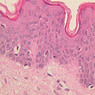 A48, Abdominal Skin, 40x (H&E)