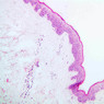 A48, Abdominal Skin (Dark), 10x (H&E)