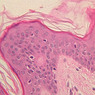 A48, Abdominal Skin, 40x (H&E)