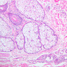 A48, Abdominal Skin, 10x (H&E)