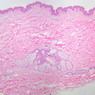 A48, Abdominal Skin, 2.5x (H&E)