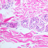 A48, Abdominal Skin, 20x (H&E)